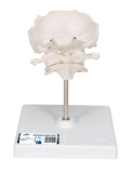 Model lidského atlasu a axisu s týlní kostí
