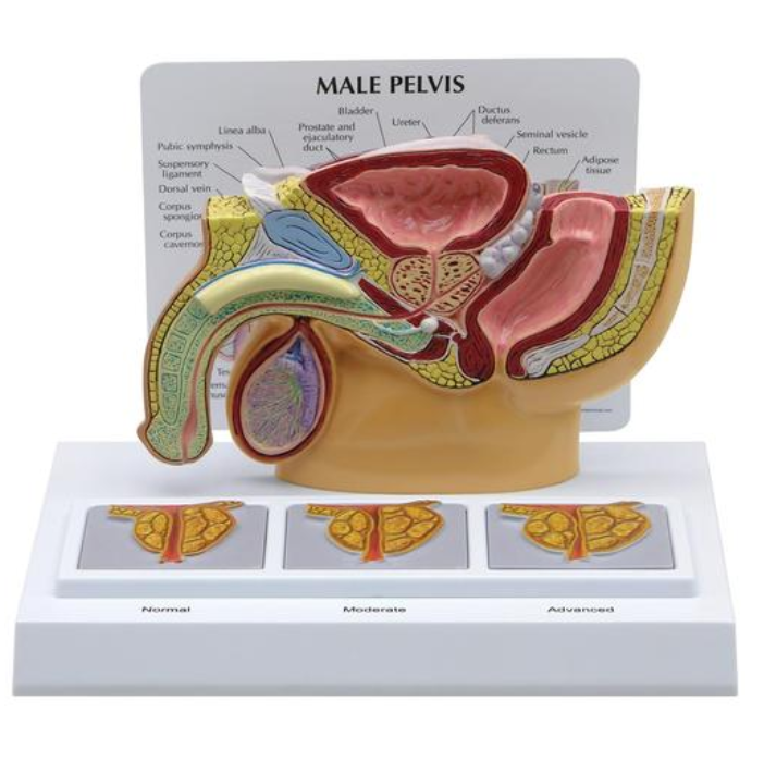 Model mužské pánve s 3D prostatou