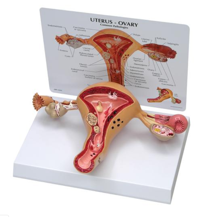 Model dělohy a vaječníků