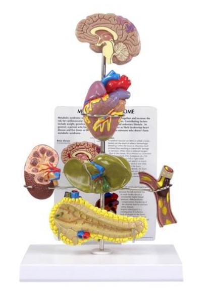 Model metabolického syndrómu 