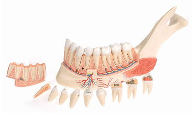 Pokročilá poloviční dolní čelist s 8 nemocnými zuby, 19 částí