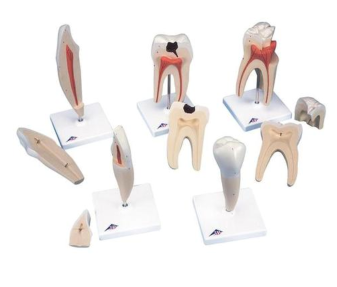 Klasický model zubů, 5 modelů