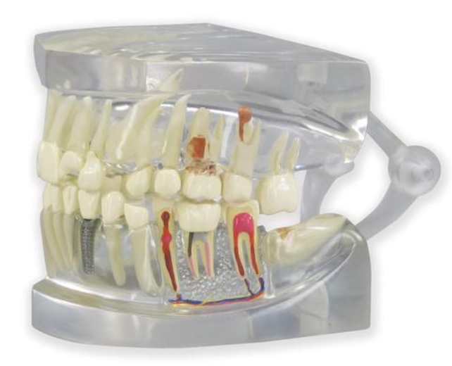 Jasný model lidské čelisti se zuby