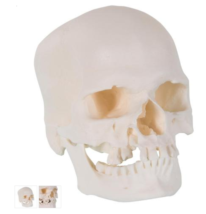 Microcephalic Human Skull Model